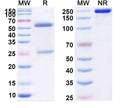 SDS-PAGE for Anti-Human INS/Insulin Monoclonal Antibody (1A399)