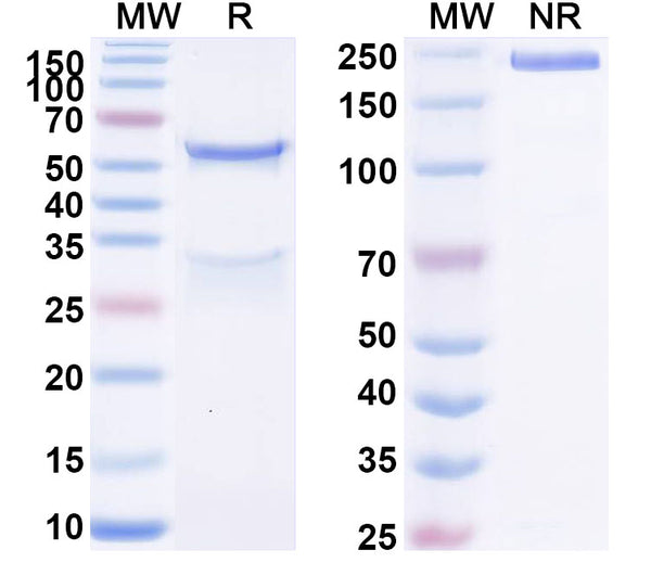 SDS-PAGE for Anti-Human Prepro-Insulin Monoclonal Antibody (1A222)