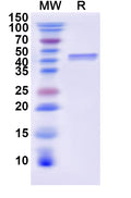 Recombinant Human CD25/IL2RA Protein, N-His-KSI