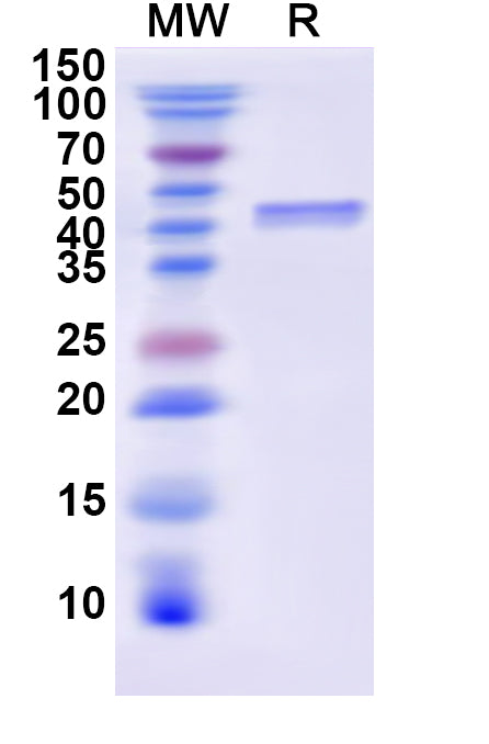 Recombinant Human CD25/IL2RA Protein, N-His-KSI