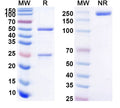 Anti-Human CD4 Reference Antibody (Clenoliximab) – Figure 1 of 1
