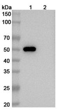 SEC-HPLC detection for Anti-Human CD4 Antibody (ABS1198).
