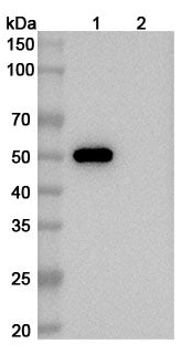 SEC-HPLC detection for Anti-Human CD4 Antibody (ABS1198).