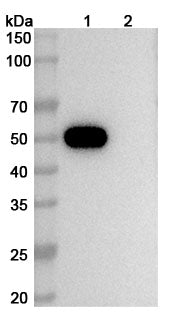 SEC-HPLC detection for Anti-Human CD4 Antibody (5A8).