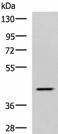 SYT2 Polyclonal Antibody – Figure 1 of 2