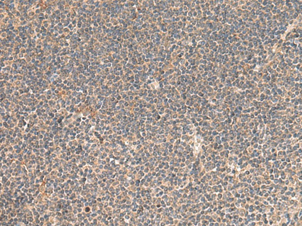 KCNE3 Polyclonal Antibody – Figure 1 of 2