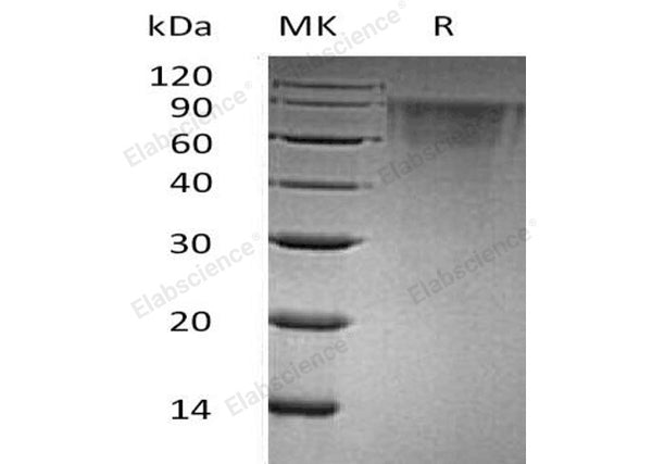 Recombinant Human THSD1/TMTSP Protein (His Tag) – Figure 1 of 2