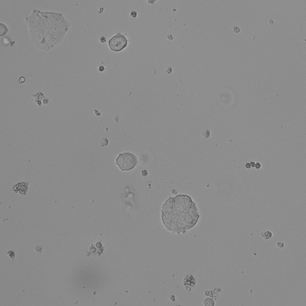 HHC6548 T1 M1 cell