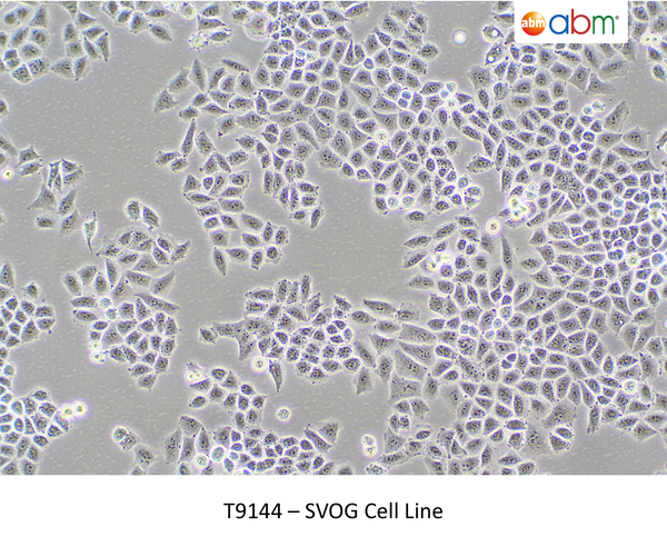 SVOG Cell Line – Figure 1 of 1