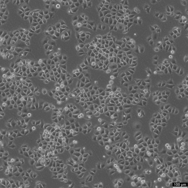 HK-CRISPR-Nup62-mEGFP cell – Figure 1 of 1