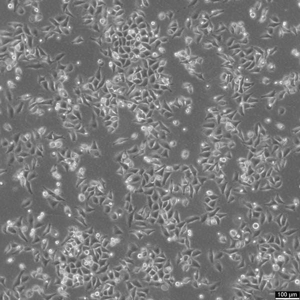 HK-CRISPR-Pom121-mCherry cell