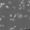 HK-CRISPR-Tpr-mEGFP cell – Figure 1 of 1