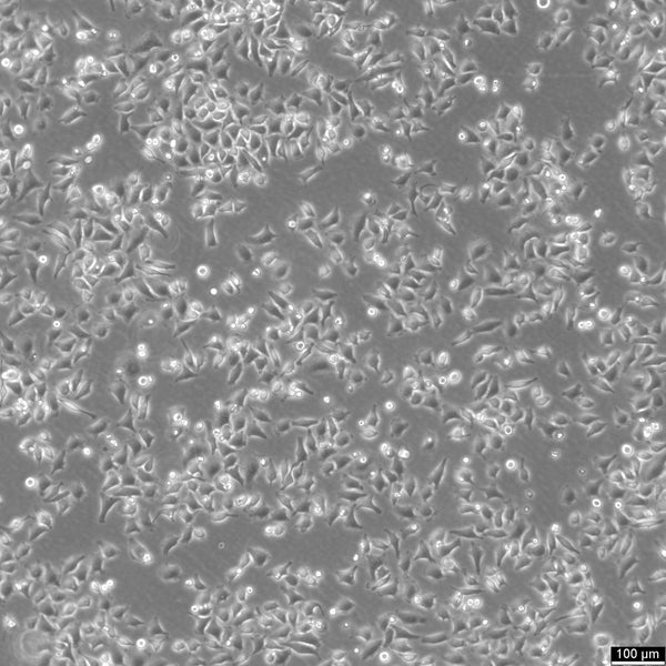 HK-CRISPR-mEGFP-Nup153 cell