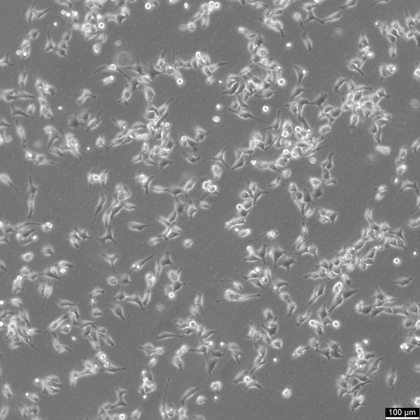 HK EGFP-alpha-tubulin/H2B-mCherry cell