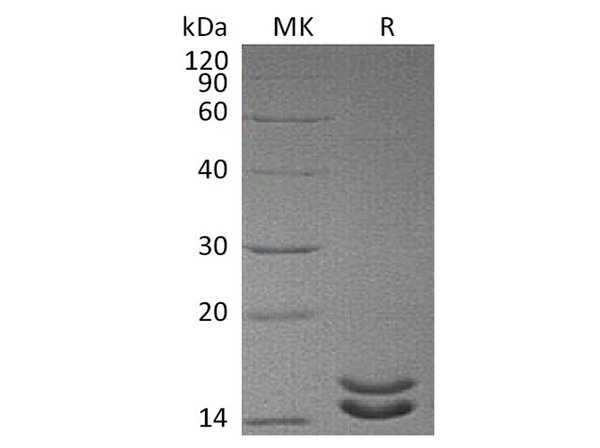 Recombinant Human Interleukin-2/IL-2 Protein (Mutant) - Figure 1 of 2