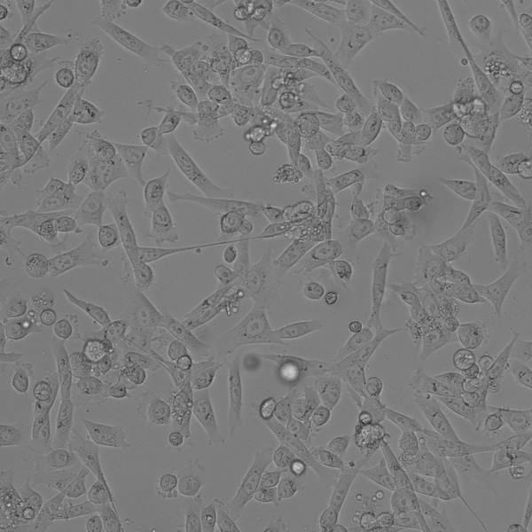 Immortalized HK/FDC cell