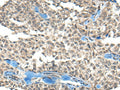 REST Polyclonal Antibody – Figure 1 of 2