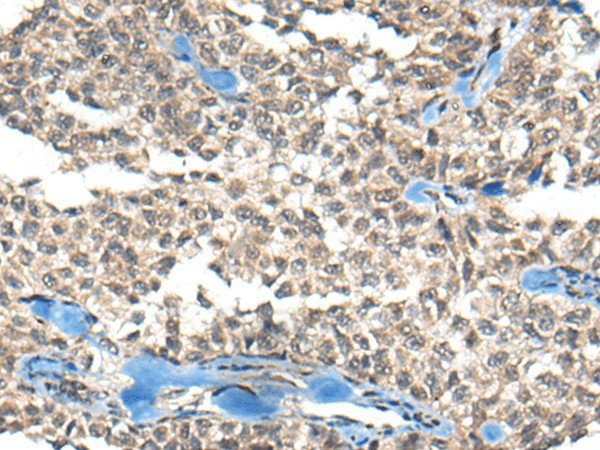 REST Polyclonal Antibody – Figure 1 of 2