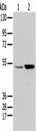 EGR2 Polyclonal Antibody – Figure 1 of 2