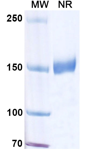 Anti-Human HLA-DRB1 Reference Antibody (Oncolym) – Figure 1 of 1