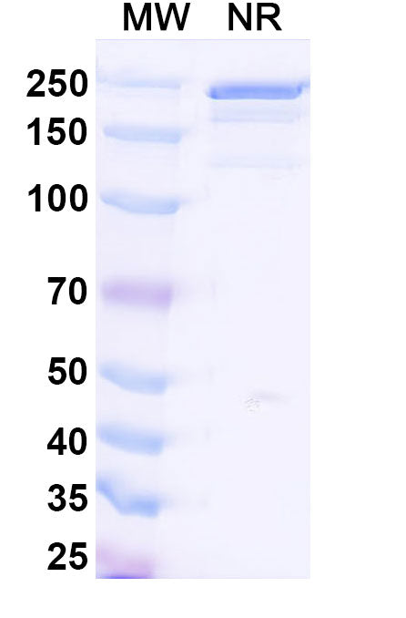 SDS-PAGE for Anti-HLA-A2-peptide (SLLMWITQV) Complex (3M4E5).
