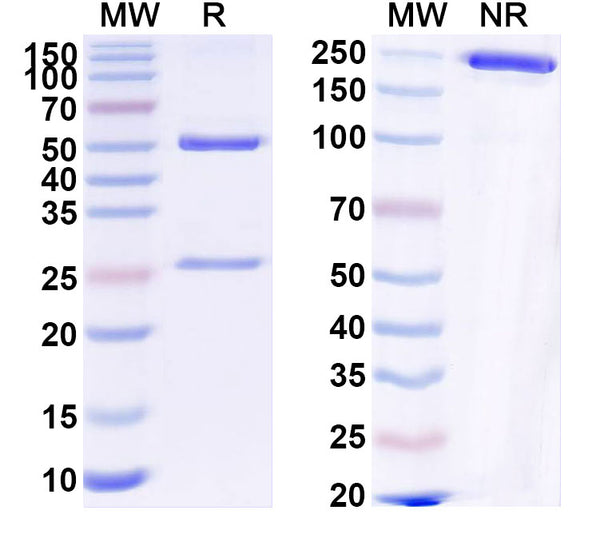 SDS-PAGE for Anti-HLA-A2-peptide (RMFPNAPYL) Complex (ESK1).