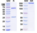 SDS-PAGE for Anti-HLA-A2-peptide (LLFGYPVYV) Complex (T3F2)