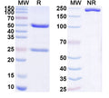 SDS-PAGE for Anti-HLA-A2-peptide (ILAKFLHWL) Complex (4B4).