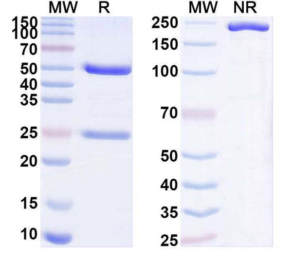 SDS-PAGE for Anti-HLA-A2-peptide (ILAKFLHWL) Complex (4B4).
