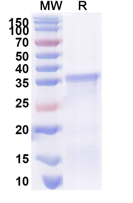 Recombinant Human HLA-A Protein, N-His