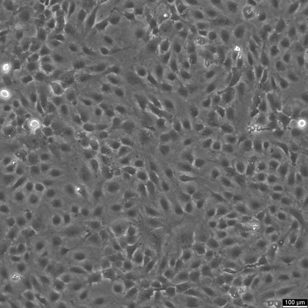 HMEC-1 cell