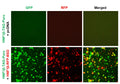 HNF1β Reporter Lentivirus – Figure 1 of 7