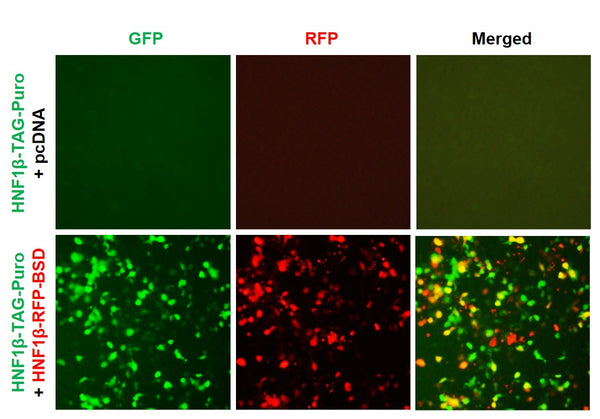 HNF1β Reporter Lentivirus – Figure 1 of 7