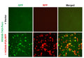 HOXA9 Reporter Lentivirus – Figure 1 of 7