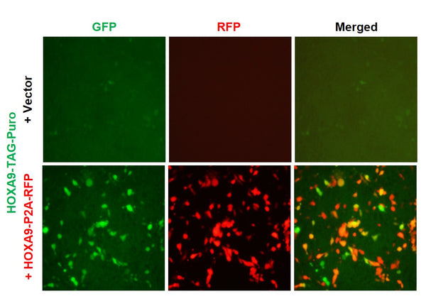 HOXA9 Reporter Lentivirus – Figure 1 of 7