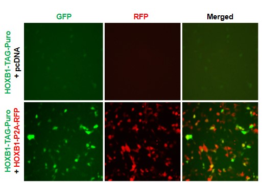 HOXB1 Reporter Lentivirus – Figure 1 of 7