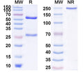 Anti-Human Nogo Reference Antibody (Ozanezumab) – Figure 1 of 1