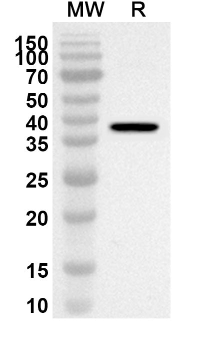 Western blot analysis was performed using anti-PROK2 polyclonal antibody at 1ug/mL on recombinant PROK2 (Catalog No. HP039012).