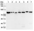 Western blot analysis was performed using anti-AFG3L2 polyclonal antibody at 1μg/ml on various samples.
Lane 1: Mouse kidney lysate
Lane 2: Mouse brain lysate
Lane 3: Rat kidney lysate
Lane 4: Rat brain lysate
Lane 5: Rat liver lysate
Lane 6: Mouse cerebellum lysate
Lane 7: Rat cerebellum lysate