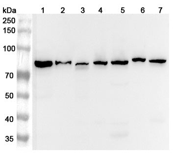 Western blot analysis was performed using anti-AFG3L2 polyclonal antibody at 1μg/ml on various samples.
Lane 1: Mouse kidney lysate
Lane 2: Mouse brain lysate
Lane 3: Rat kidney lysate
Lane 4: Rat brain lysate
Lane 5: Rat liver lysate
Lane 6: Mouse cerebellum lysate
Lane 7: Rat cerebellum lysate