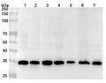 Western blot analysis was performed using anti-STUB1 polyclonal antibody at 1μg/ml on various samples.
Lane 1: L929 cell lysate
Lane 2: Hela cell lysate
Lane 3: NIH3T3 cell lysate
Lane 4: A549 cell lysate
Lane 5: PC-12 cell lysate
Lane 6: Mouse brain lysate
Lane 7: Rat brain lysate