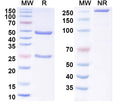 SDS-PAGE for Anti-Human TRIM33 Antibody (SAA1438)