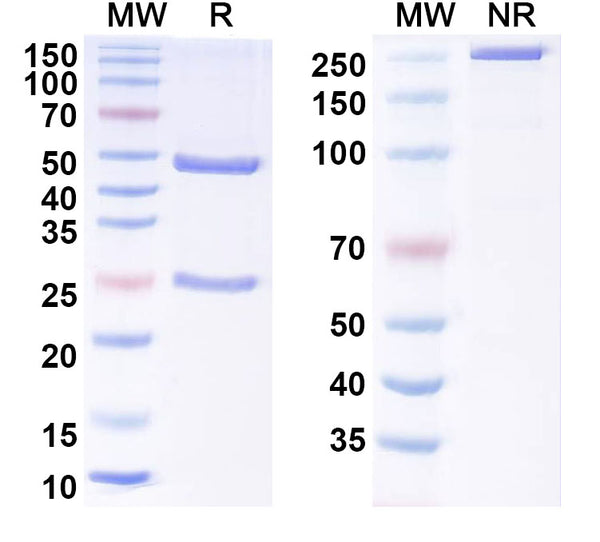 SDS-PAGE for Anti-Human TRIM33 Antibody (SAA1438)