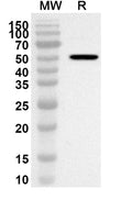 Western blot analysis was performed using anti-Human TRIM33 polyclonal antibody at 1ug/mL on recombinant Human TRIM33 (Catalog No. HP145022).