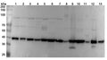 Western blot analysis was performed using anti-DNAJB11 polyclonal antibody at 1μg/ml on various samples.
Lane 1: Raji cell lysate
Lane 2: Hela cell lysate
Lane 3: HepG2 cell lysate
Lane 4: A549 cell lysate
Lane 5: 293T cell lysate
Lane 6: MCF7 cell lysate
Lane 7: NIH3T3 cell lysate
Lane 8: Mouse heart lysate
Lane 9: Mouse liver lysate
Lane 10: Mouse lung lysate
Lane11: Rat heart lysate
Lane12: Rat liver lysate
Lane13: Rat lung lysate