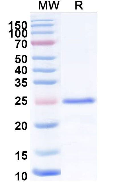 Recombinant Human UHRF1 Protein, N-His