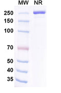 Anti-Human Transthyretin/Prealbumin Reference Antibody (Coramitug) – Figure 1 of 1