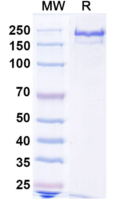 SDS-PAGE for Anti-Human ATTR/Transthyretin amyloidosis Antibody (NI301A).