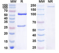 Detects Recombinant Human ASTL/Ovastacin Protein, C-His (Cat No.: HP237011) in indirect ELISA.