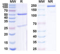 SDS-PAGE for Anti-QKI-7 Antibody (N183/15).